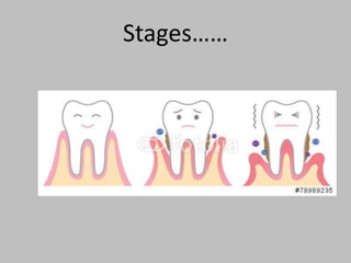 Stages……
 