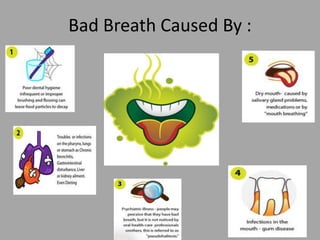 Bad Breath Caused By :
 