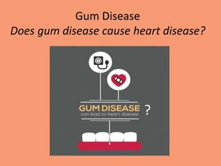 Gum Disease
Does gum disease cause heart disease?
?
 