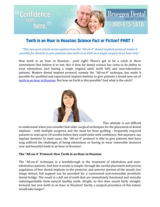 Teeth in an Hour in Houston: Science Fact or Fiction? PART 1

  “This two-part article series explains how the “All-on-4” dental implant protocol makes it
possible for dentists to give patients new teeth in as little as a single surgery of an hour only.”

New teeth in an hour in Houston… yeah right! There’s got to be a catch in there
somewhere! But believe it or not, this is how far dental science has come in its ability to
treat edentulous (not having a single original adult tooth left) and near-edentulous
patients. Modern dental implant protocol, namely the “All-on-4” technique, has made it
possible for qualified and experienced implant dentists to give patients a brand new set of
teeth in an hour in Houston. But how on Earth is this possible? And what is the catch?




                                                               This attitude is not difficult
to understand when you consider that older surgical techniques for the placement of dental
implants - with multiple surgeries and the need for bone grafting - frequently required
patients to wait up to 18 months before they could smile with confidence. Not anymore, say
implant dentists! In most cases, the “All-on-4” protocol is able to give patients that have
long suffered the challenges of being edentulous or having to wear removable dentures
new and beautiful teeth in an hour in Houston!

The “All-on-4” Protocol: New Teeth in an Hour in Houston

The “All-on-4” technique is a breakthrough in the treatment of edentulous and near-
edentulous patients. And how it works is simple: through the careful placement and precise
angulation of four dental implants in the posterior and anterior portion of the mouth (see
image below), full support can be provided for a customized non-removable prosthetic
dental bridge. The result is a full set of teeth that are immediately functional and virtually
indistinguishable from natural healthy teeth. Alright, so this does sound fairly straight-
forward, but new teeth in an hour in Houston? Surely a surgical procedure of this nature
would take longer?
 