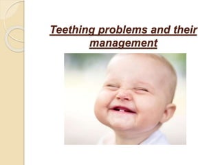 Teething problems and their
management
 