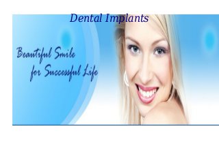 Dental Implants
 