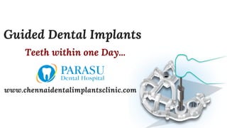Guided Dental Implants
Teeth within  one Day...
www.chennaidentalimplantsclinic.com
 
