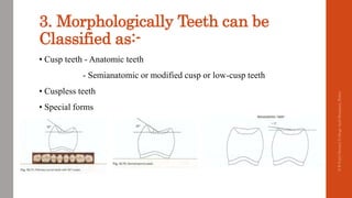 TEETH SELECTION IN COMPLETE DENTURE | PPTX