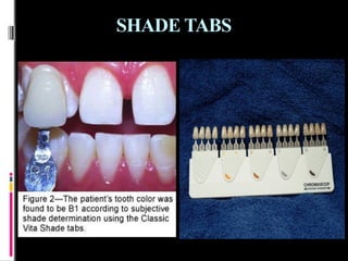 TEETH SELECTION for complete edentulism condition | PPTX