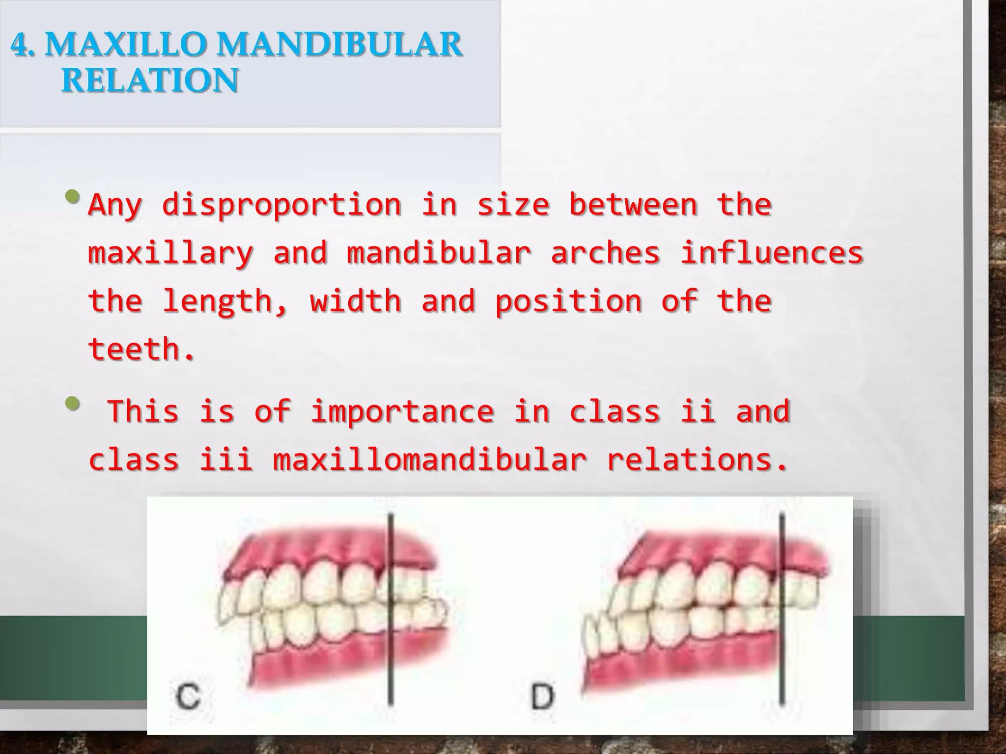 Teeth selection for complete dentures | PPTX