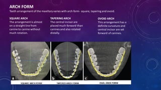 Teeth selection and arrangement | PDF