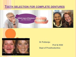 TEETH SELECTION FOR COMPLETE DENTURES
Dr Puttaraju
Prof & HOD
Dept of Prosthodontics
 