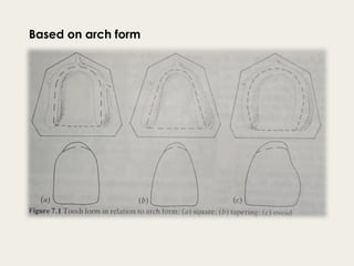 teeth selection in complete denture.pptx