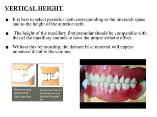 teeth selection in complete denture.pptx