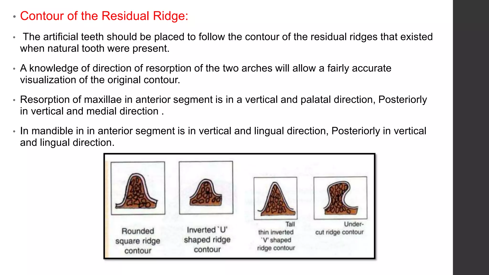 Tooth Ridges Teeth selection in complete dentures | PPTX