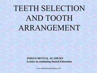 TEETH SELECTION
AND TOOTH
ARRANGEMENT
INDIAN DENTAL ACADEMY
Leader in continuing Dental Education
www.indiandentalacademy.com
 