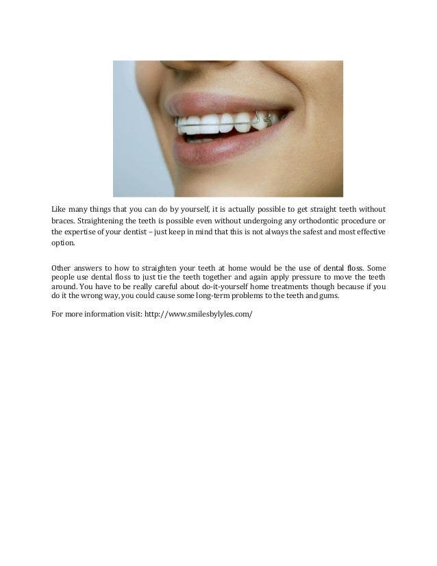 How To Straightening Teeth Without Braces
