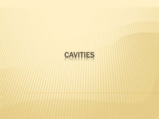 CAVITIES
 