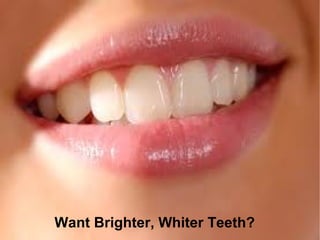Want Brighter, Whiter Teeth?

 