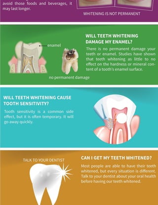 Teeth Whitening FAQs