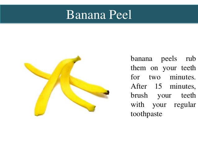 Do banana peels whiten the teeth?
