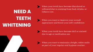 When your teeth have become discolored or
yellowed due to staining from food, drinks, or
tobacco use.
When you want to improve your overall
appearance and boost your self-confidence.
When your teeth have become dull or stained
due to age or medication use.
When you want to maintain a bright, white smile
as part of your regular oral hygiene routine.
NEED A
TEETH
WHITENING
 