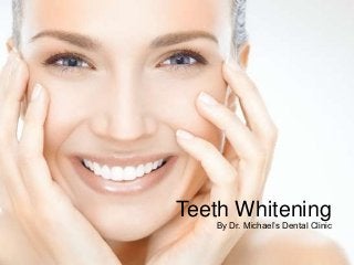 Teeth Whitening
   By Dr. Michael’s Dental Clinic
 