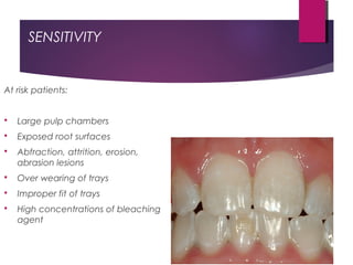 SENSITIVITY
At risk patients:
 Large pulp chambers
 Exposed root surfaces
 Abfraction, attrition, erosion,
abrasion lesions
 Over wearing of trays
 Improper fit of trays
 High concentrations of bleaching
agent
 