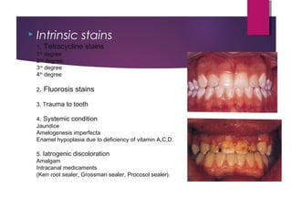  Intrinsic stains
1. Tetracycline stains
1st
degree
2nd
degree
3rd
degree
4th
degree
2. Fluorosis stains
3. Trauma to tooth
4. Systemic condition
Jaundice
Amelogenesis imperfecta
Enamel hypoplasia due to deficiency of vitamin A,C,D.
5. Iatrogenic discoloration
Amalgam
Intracanal medicaments
(Kerr root sealer, Grossman sealer, Procosol sealer).
 
