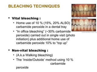BLEACHING TECHNIQUES

 Vital bleaching :
  • Home use of 10 % (15%, 20% ALSO)
    carbamide peroxide in a dental tray
  • “In office bleaching” (~30% carbamide
    peroxide) carried out in single visit (photo
    initiation) plus additional home use of
    carbamide peroxide 10% to “top up”

 Non-vital bleaching :
  • (A.k.a Walking bleaching)
  • The ‘Inside/Outside’ method using 10 %
                           carbamide
    peroxide
 