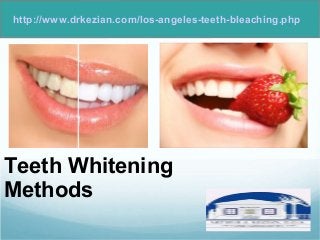 http://www.drkezian.com/los-angeles-teeth-bleaching.php 
Teeth Whitening 
Methods 
 