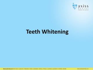 Teeth Whitening

 