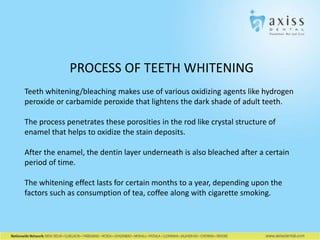 PROCESS OF TEETH WHITENING
Teeth whitening/bleaching makes use of various oxidizing agents like hydrogen
peroxide or carbamide peroxide that lightens the dark shade of adult teeth.
The process penetrates these porosities in the rod like crystal structure of
enamel that helps to oxidize the stain deposits.
After the enamel, the dentin layer underneath is also bleached after a certain
period of time.
The whitening effect lasts for certain months to a year, depending upon the
factors such as consumption of tea, coffee along with cigarette smoking.

 