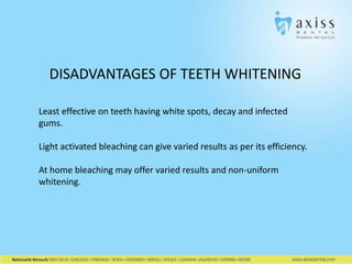 DISADVANTAGES OF TEETH WHITENING
Least effective on teeth having white spots, decay and infected
gums.
Light activated bleaching can give varied results as per its efficiency.
At home bleaching may offer varied results and non-uniform
whitening.

 