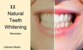 Natural
Teeth
Whitening
Remedies
Lifehack Media
12
Lifehack MediaLifehack Media
 