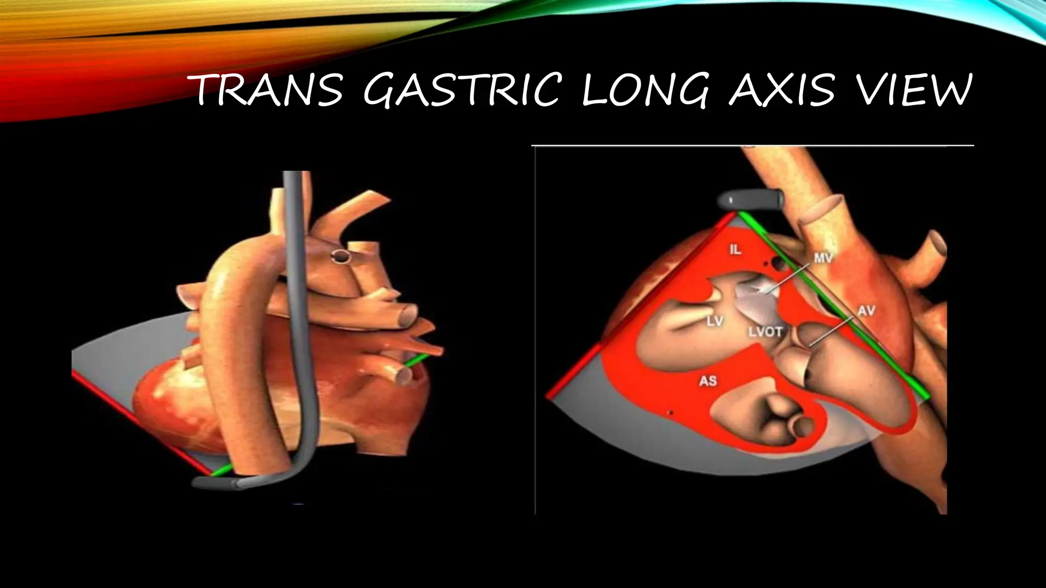 TEE VIEWS transesophageal echocardiography views.pptx
