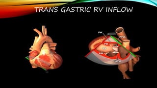 Tg Rv Inflow View Tee TEE VIEWS transesophageal echocardiography views.pptx