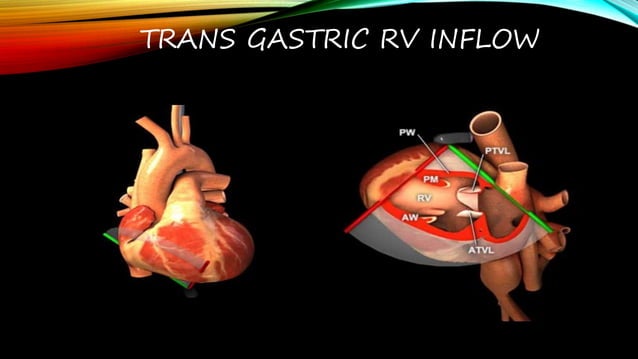 TEE VIEWS transesophageal echocardiography views.pptx | Heart and ...