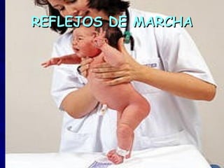 REFLEJOS DE MARCHA
 