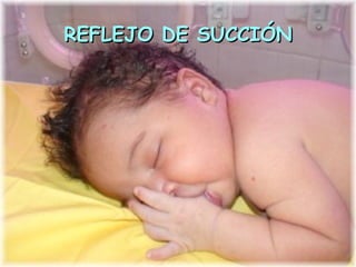 REFLEJO DE SUCCIÓN
 