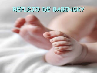 REFLEJO DE BABINSKY
 