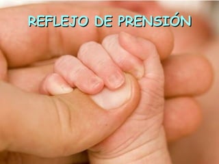 REFLEJO DE PRENSIÓN
 