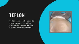 TEFLON
Teflon tape can be used to
ensure proper isolation
around the rubber dam in
case of isolation breach
 
