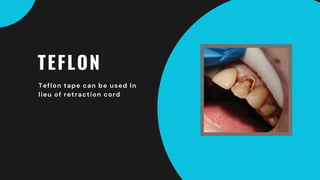 TEFLON
Teflon tape can be used In
lieu of retraction cord
 