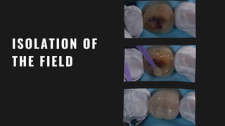 ISOLATION OF
THE FIELD
 