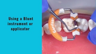 Using a Blunt
instrument or
applicator
 