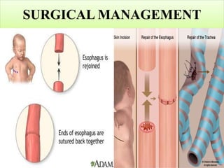 SURGICAL MANAGEMENT
 