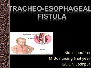 TRACHEO-ESOPHAGEAL
FISTULA
Nidhi chauhan
M.Sc nursing final year
GCON.Jodhpur
 