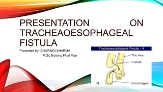 PRESENTATION ON
TRACHEAOESOPHAGEAL
FISTULA
Presented by: SHIVANGI SHARMA
M.Sc Nursing Final Year
 