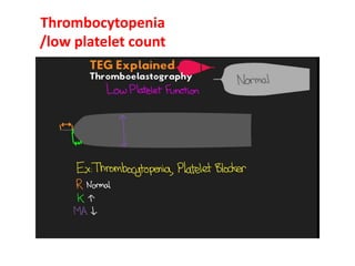Teg Testing Teg Thrombelastograph® .pptx