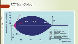 Rotem Poc TEG-and-ROTEM-Technology-and-Clinical-Applications.pptx