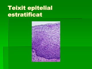 Epiteli glandular:
El formen cèl·lules epitelials especialitzades en
produir i secretar substàncies.
Les cèl·lules es sole...