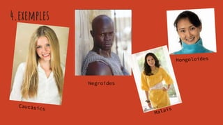 4.exemples
Negroides
 