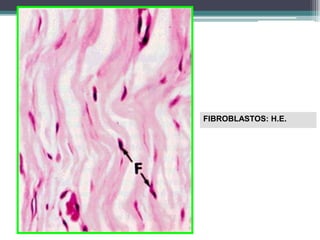 FIBROBLASTOS: H.E.
 